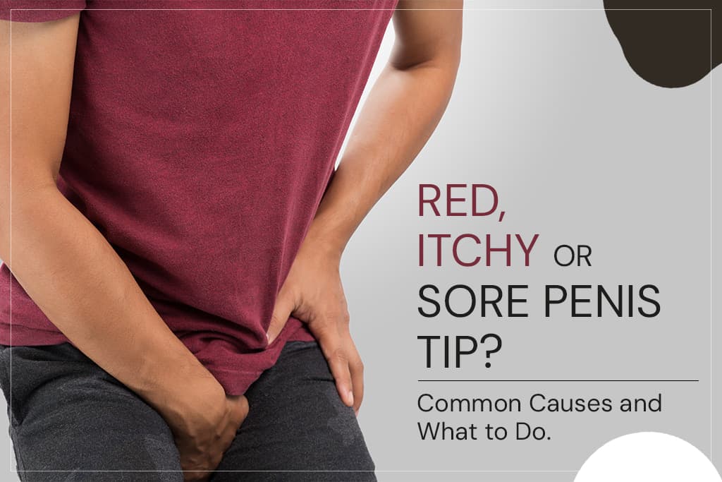 Red, Itchy or Sore Penis Tip? Common Causes and What to Do