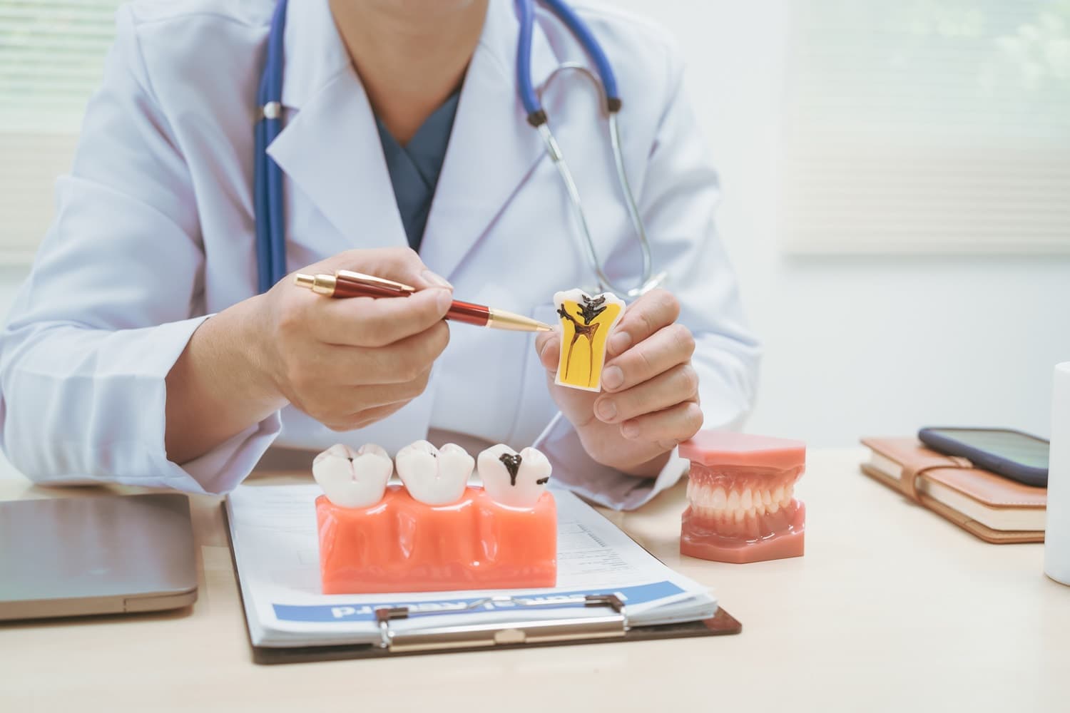 Cracked Tooth Syndrome: Symptoms, Causes, and Treatment Options