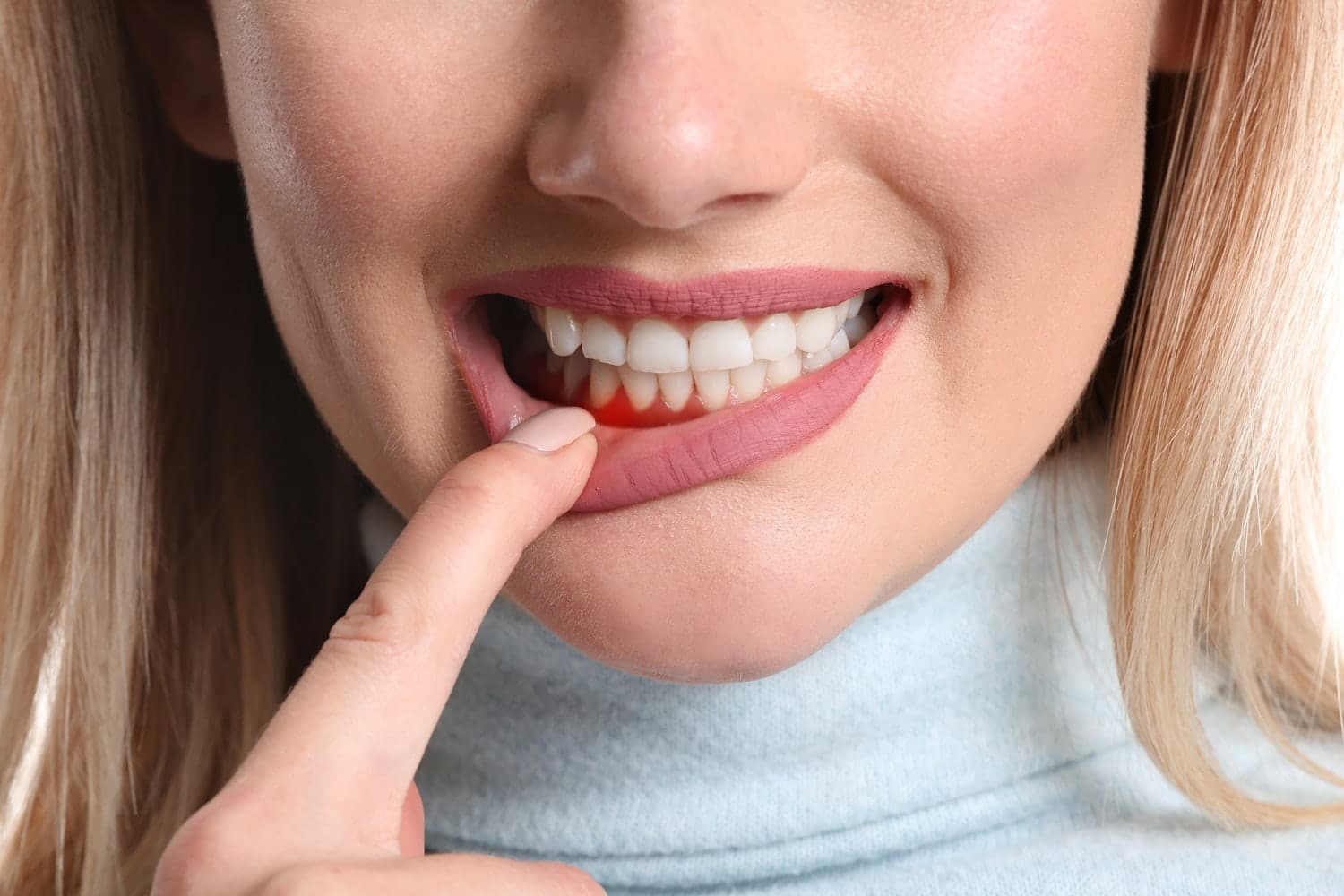 Early Signs of Gum Disease You Shouldn't Ignore