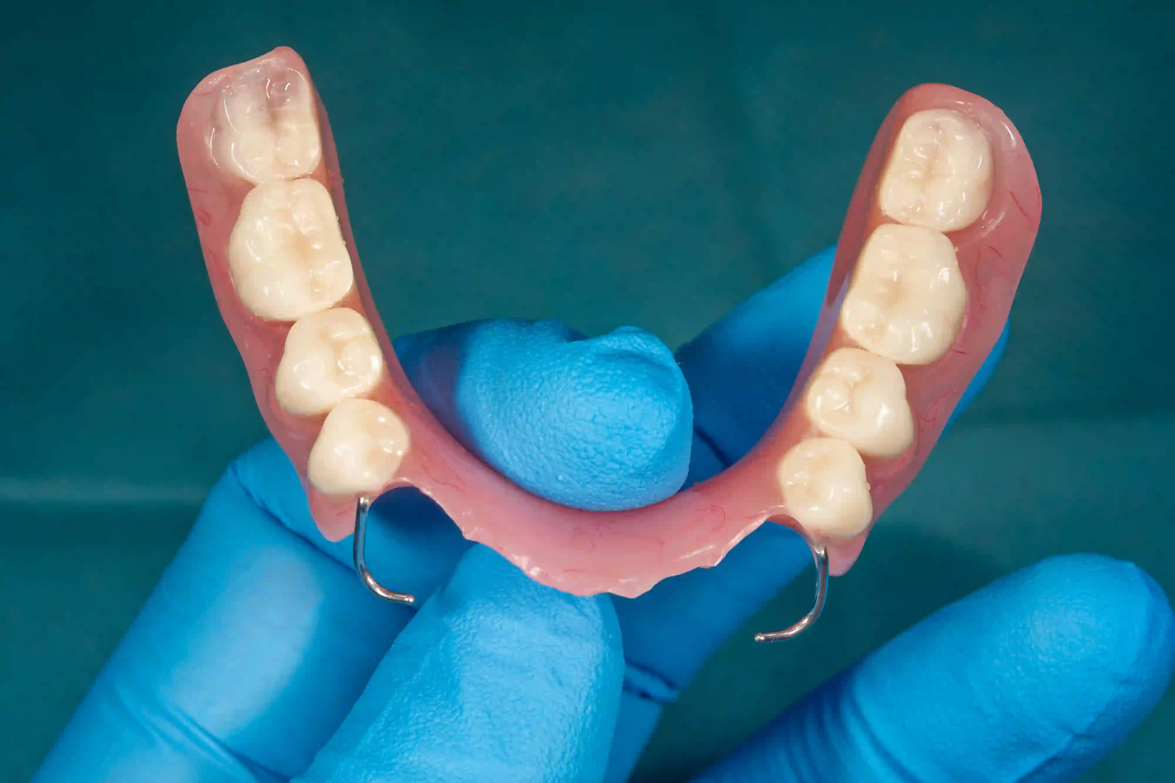 Acrylic vs. Chrome vs. Valplast: Which Partial Denture Is Right for You?