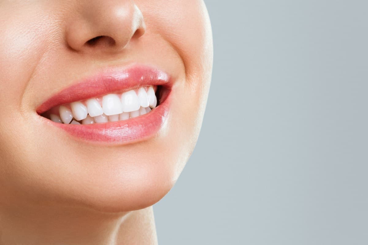 Can a Smile Makeover Be Completed in Phases to Accommodate a Patient's Budget?