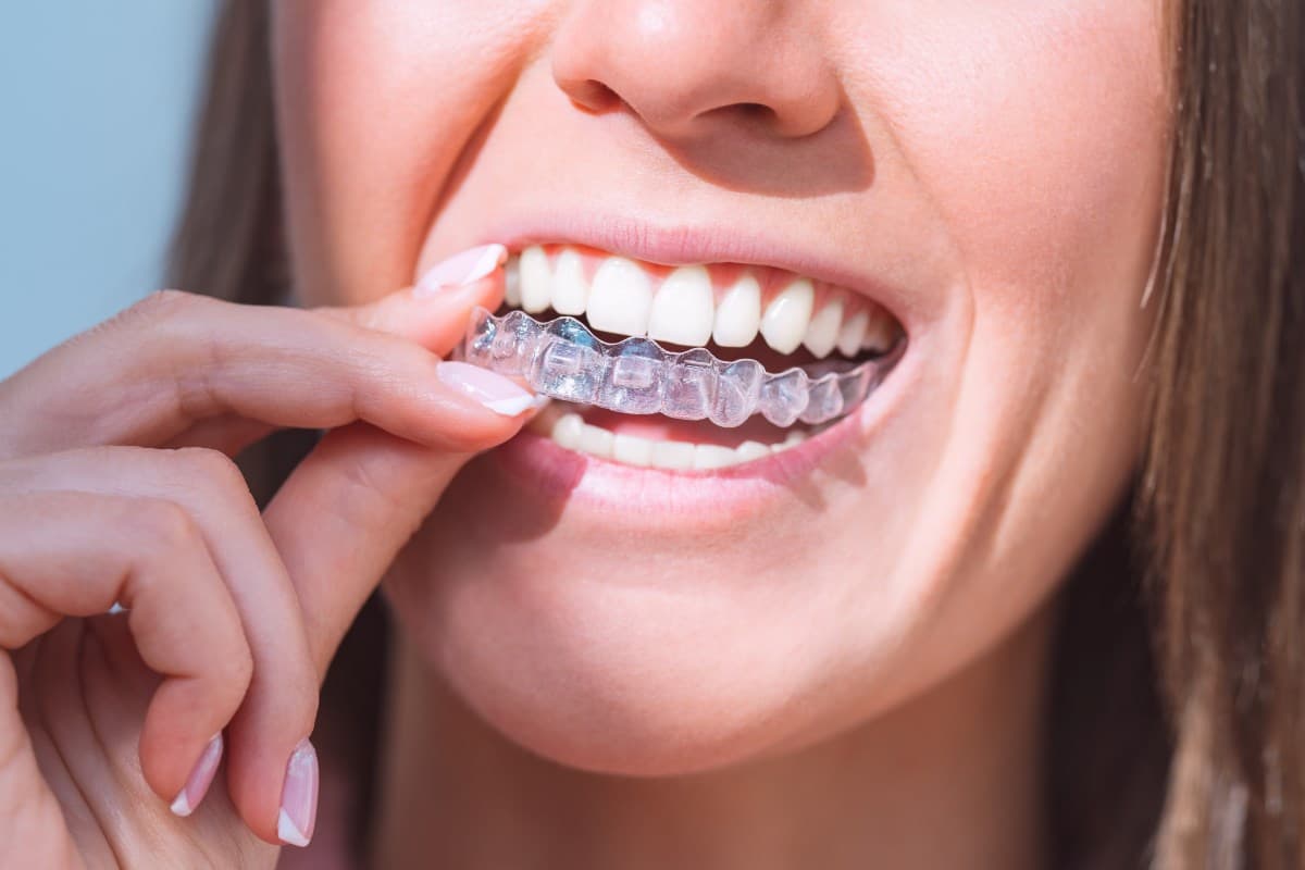 Can You Drink Clear Sugar-Free Spirits or Sparkling Water While Wearing Your Invisible Brace Aligners?