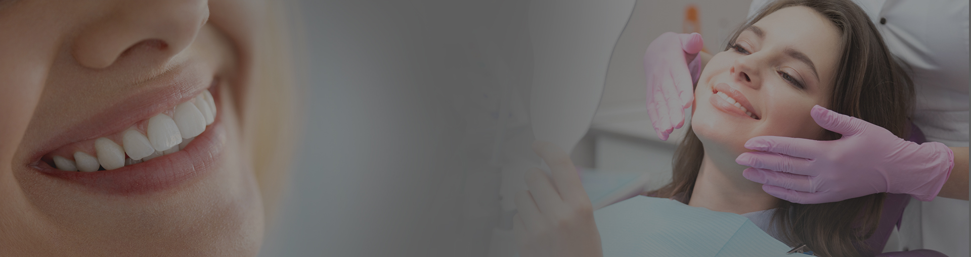 Teeth Whitening