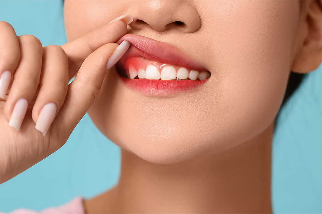 Top Warning Signs of Gum Disease You Shouldn’t Ignore